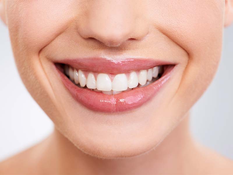 Close-up of a woman showing healthy teeth